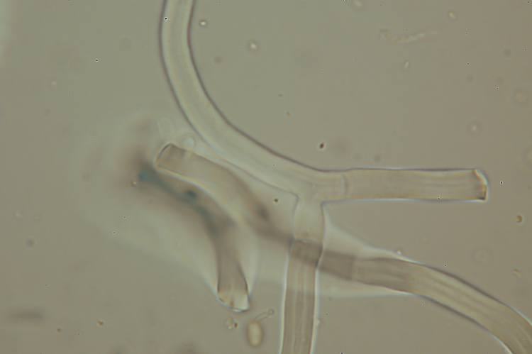 Phanerochaete avellanea  ?